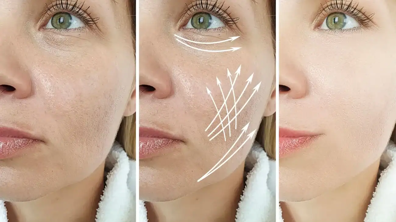 Can One Treatment Really Tackle More Than One Skin Concern Wooburn Green?