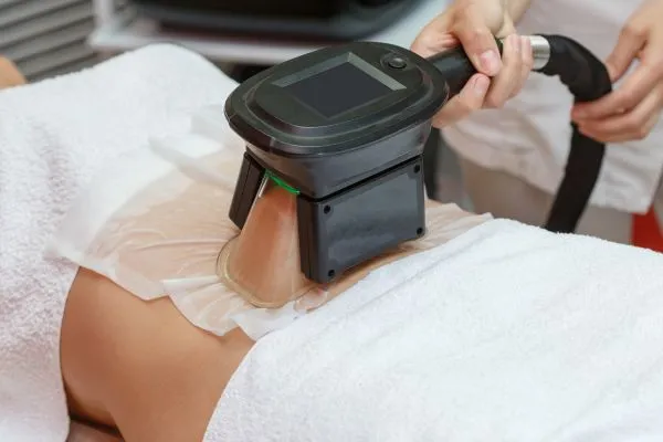 Image of person having fat freezing treatment to help weight gain Wooburn Green