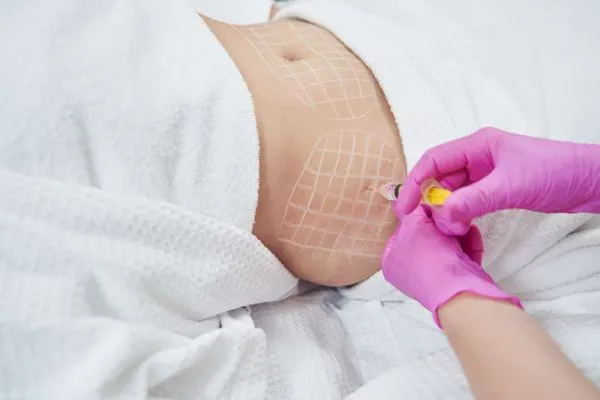 image of fat dissolving injections on love handles to help combat weight gain Wooburn Green