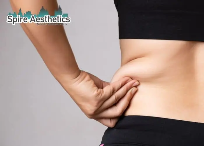 Image of woman pinching fat on their hips Wooburn Green. Fat Freezing treatment