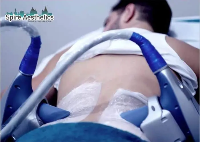 Man having fat freezing treatment done on love handles before a competitions Wooburn Green to create a sculpted look.