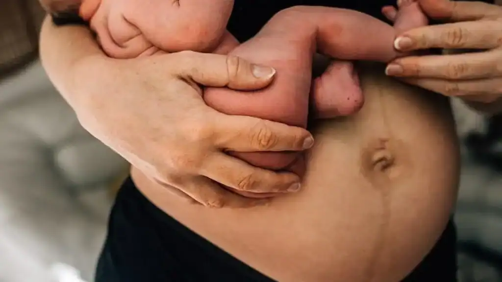 Why Is My Stomach Still Big After Pregnancy Wooburn Green?