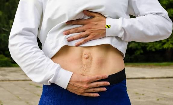 When Could Diastasis Recti Be the Missing Piece of the Puzzle Wooburn Green?